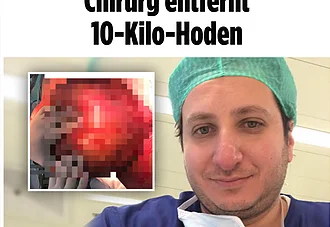 Bild: In Europa ist der Fall einmalig Chirurg entfernt 10-Kilo-Hoden